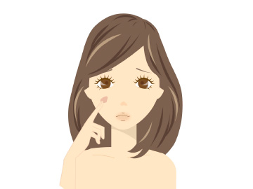 しみができた女性