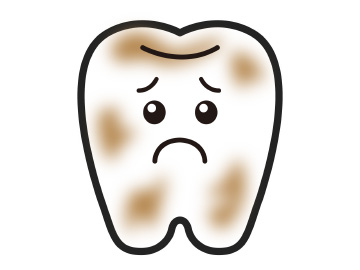 歯に付着した汚れ